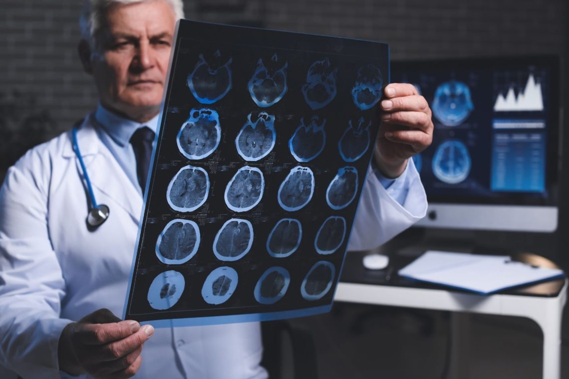 Svetovni dan Alzheimerjeve bolezni v znamenju destigmatizacije bolezni