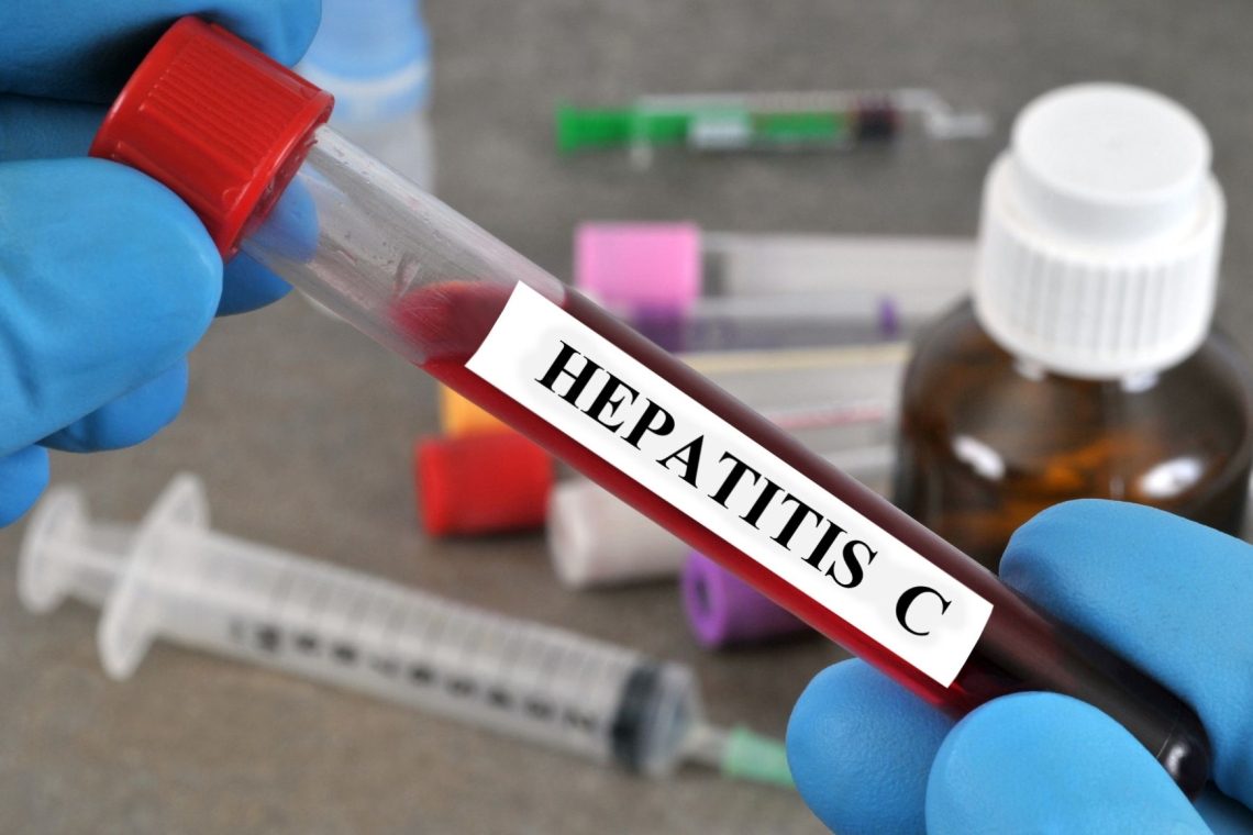 Kaj je virusni hepatitis C?