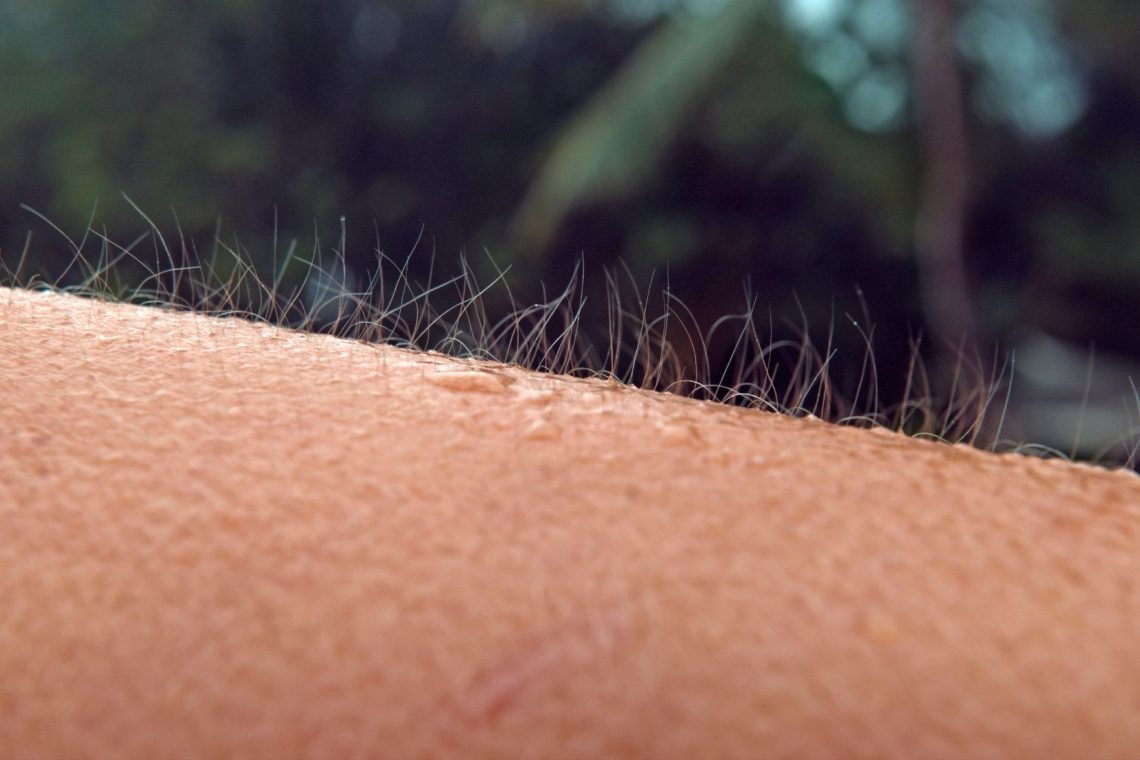 Zakaj dobimo kurjo kožo?
