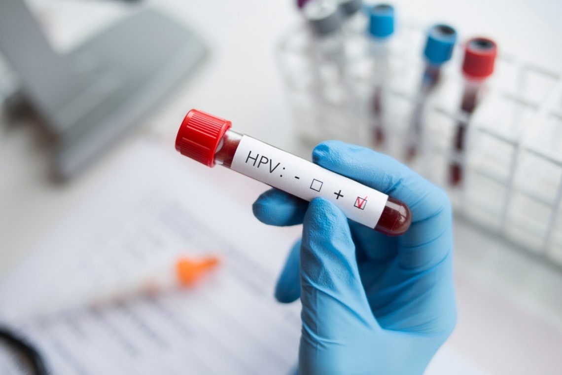 Zaščitite se za prihodnost – cepljenje proti HPV v ZD za študente Univerze v Ljubljani