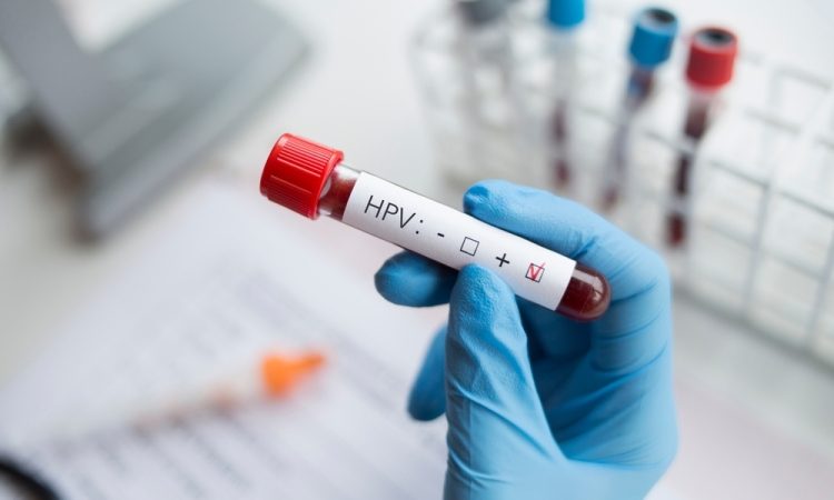Zaščitite se za prihodnost – cepljenje proti HPV v ZD za študente Univerze v Ljubljani