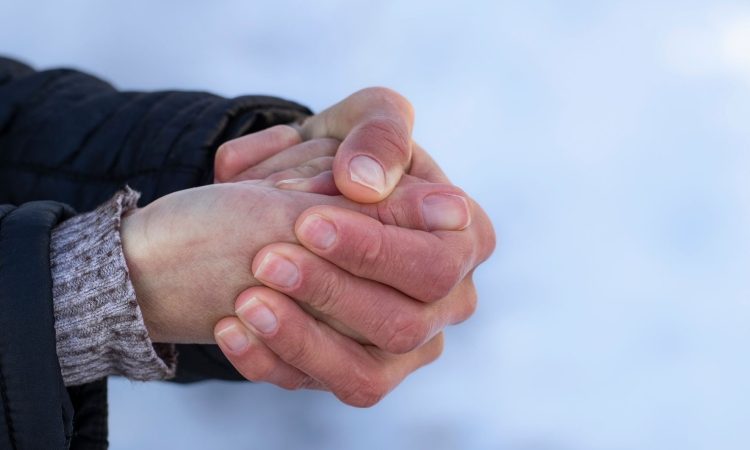 Kaj povzroča rdeče dlani in kdaj poiskati pomoč?