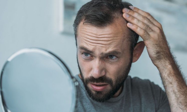 Sladke in energijske pijače lahko prispevajo k izpadanju las in tesnobi