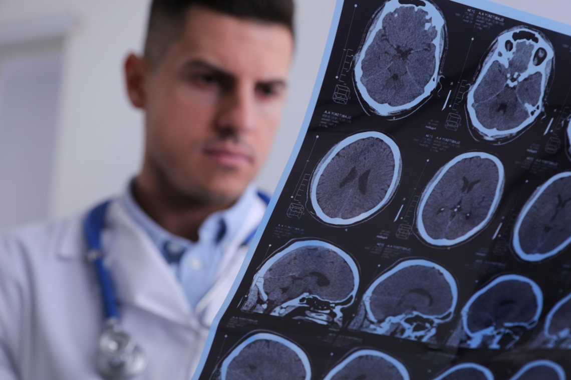 Epilepsija v Sloveniji ostaja stigmatizirana, sogovorniki poudarili več ozaveščanja